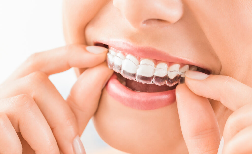 Patient With Invisalign Retainer In Wolverhampton